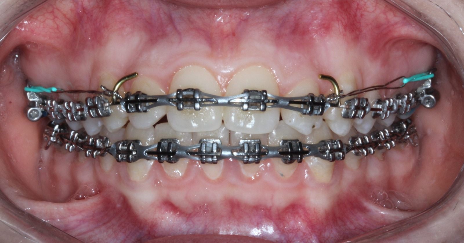 Clinical photograph