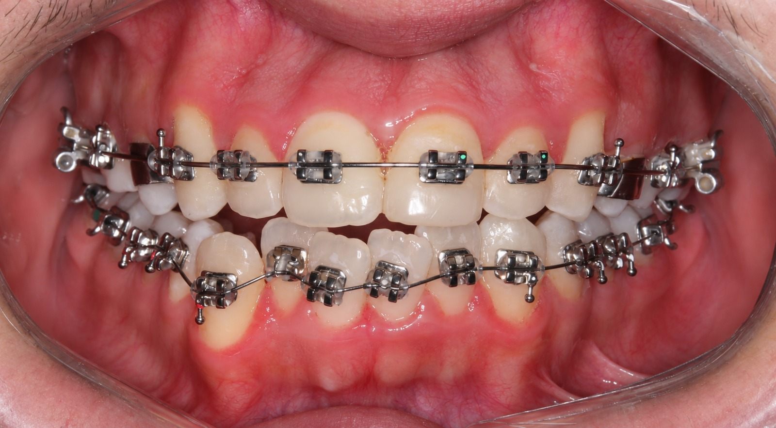 Clinical photograph